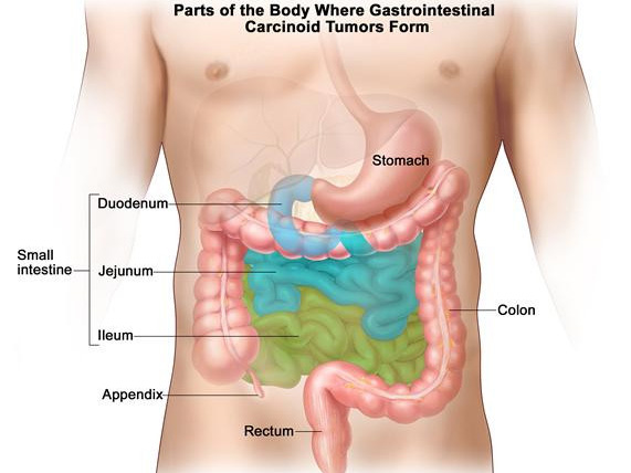 Where is Your Appendix Located on Female and Male Body